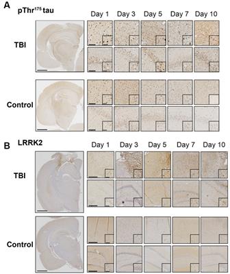 Upregulation of LRRK2 following traumatic brain injury does not directly phosphorylate Thr175 tau